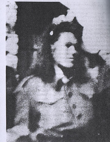 skorna